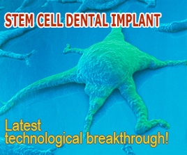 Arrange a stem-cell-implant